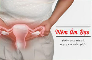 viêm âm đạo