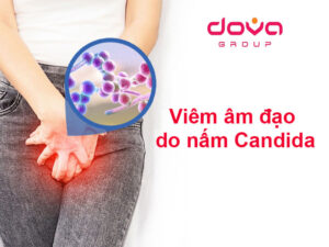 Viêm âm đạo do nấm Candida