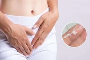 Phân biệt khí hư bất thường và khí hư bình thường