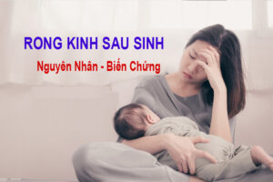 rong kinh sau sinh